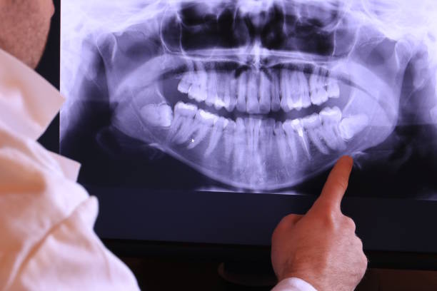 Best Dental Abscess Treatment in Swansea, IL